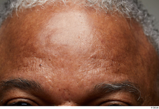 HD Face Skin Everson Baker face forehead skin pores skin…